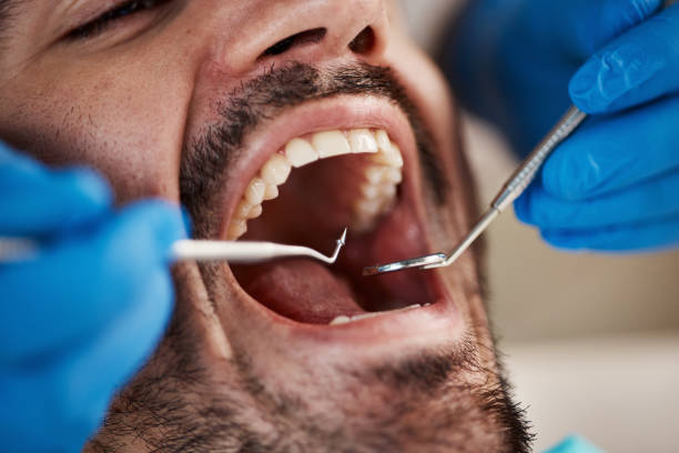 Best Tooth Pain Emergency Relief  in Katy, TX